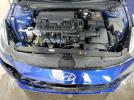 Hyundai ELANTRA Se Image 12